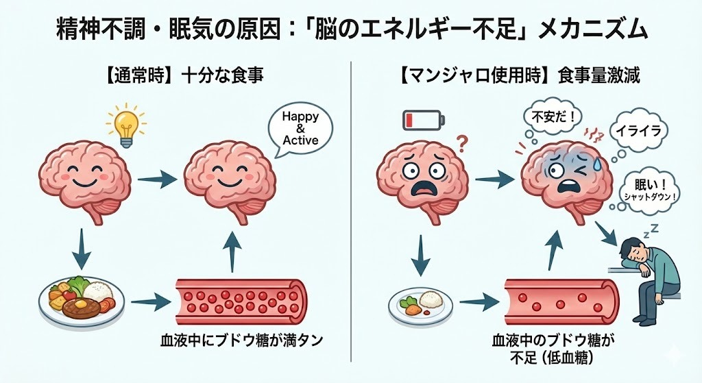 精神不調や眠気の原因が「脳のエネルギー不足」であることを示す比較図。左側は通常時で、十分な食事により血液中にブドウ糖が満タンになり、脳が元気に活動している。右側はマンジャロ使用時で、食事量が激減し、血液中のブドウ糖が不足(低血糖)した結果、脳がエネルギー切れで不安やイライラ、眠気を起こしている様子が描かれている。