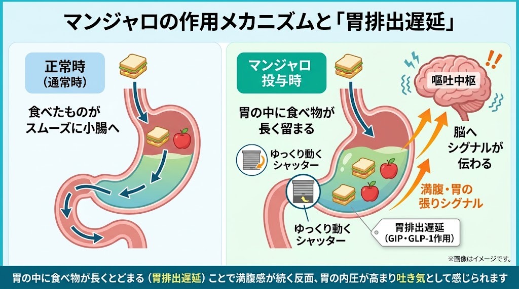 マンジャロの作用メカニズムと胃排出遅延による吐き気発生の仕組み