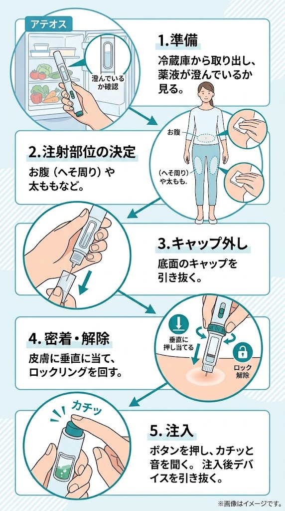 アテオス専用ペンを使った自己注射の5つの正しい手順イラスト
