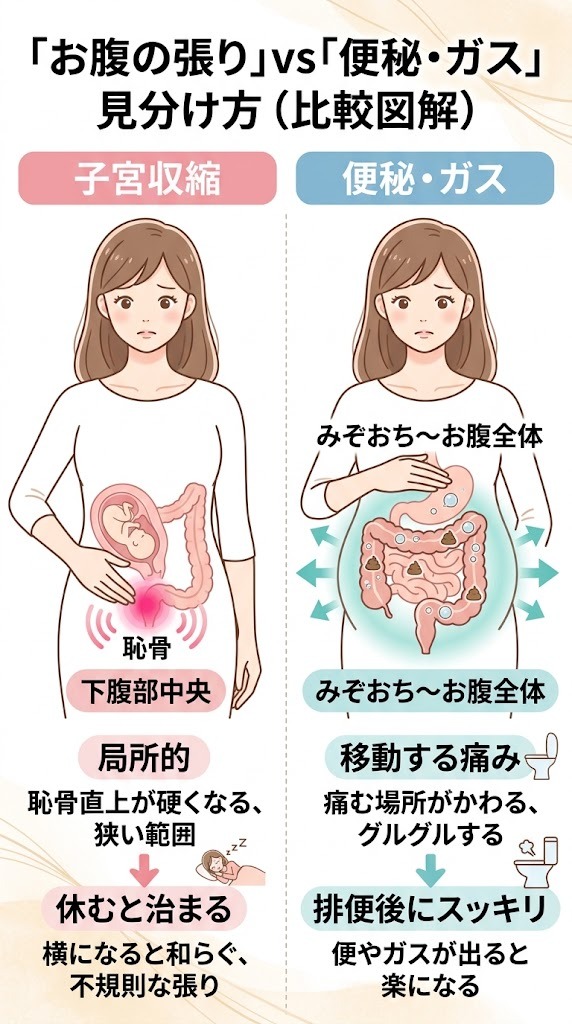 子宮収縮によるお腹の張りと便秘・ガスによる膨満感の症状や場所の違いを示す比較図解